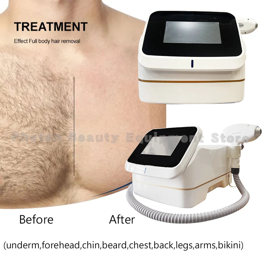 Professional Mini Diode Ice Titanium Laser  Hair Removal Machine 755 808 940 1064nm 4000w Painless Permanent CE
