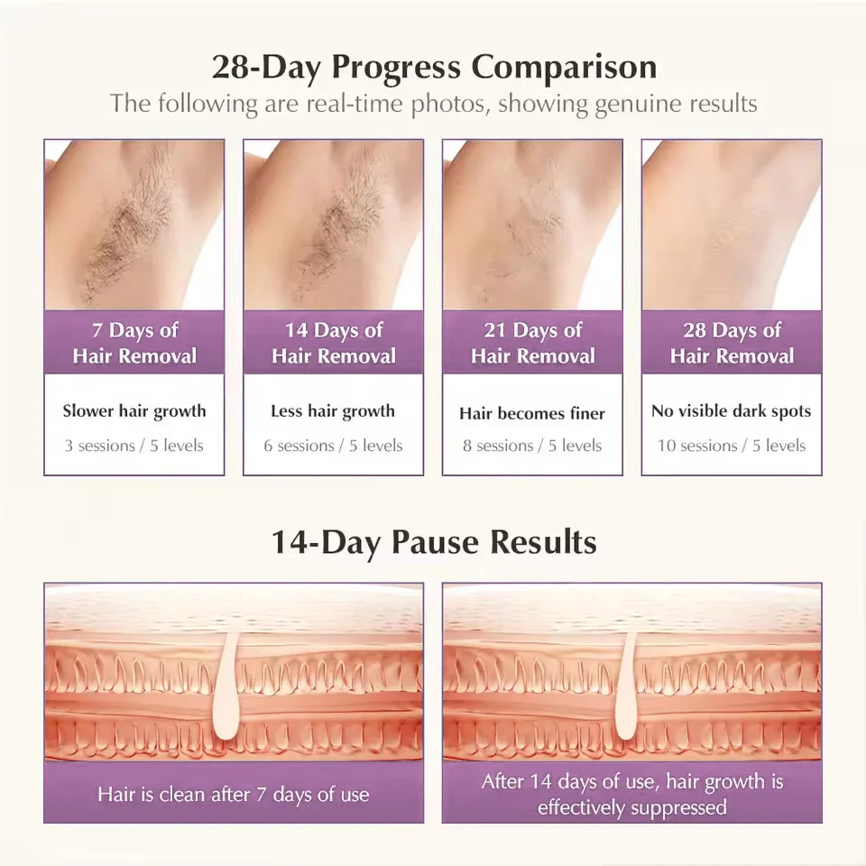 Malay Laser MLAY T14 IPL Ice Cool Laser Hair Removal Device Original Hair Removal Replaceable Lamps Home Epilator For Men Women