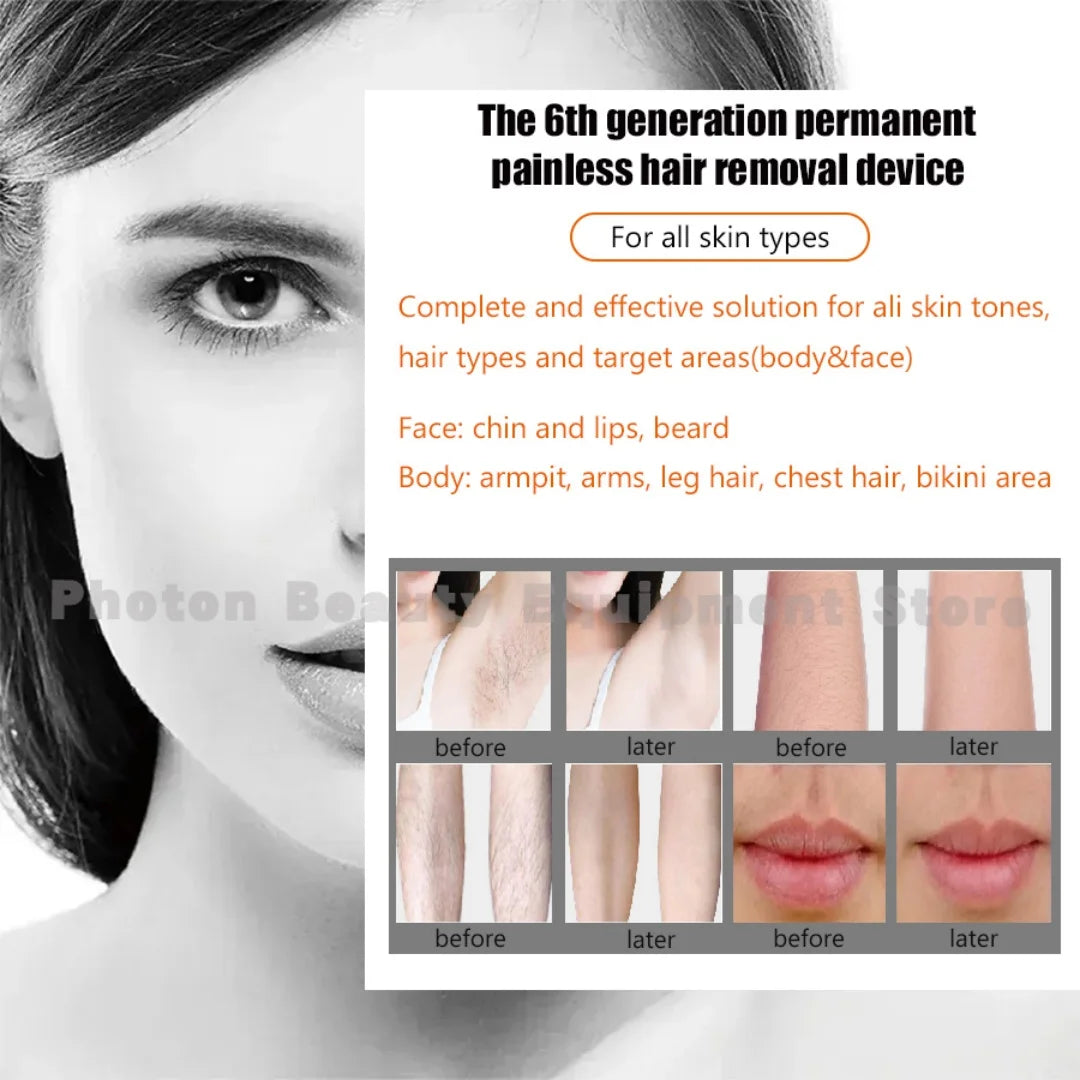 Professional Mini Diode Ice Titanium Laser  Hair Removal Machine 755 808 940 1064nm 4000w Painless Permanent CE